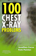 100 Chest X-Ray Problems