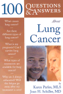 100 Questions and Answers about Lung Cancer: .