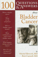 100 Questions & Answers about Bladder Cancer