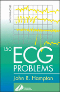 150 ECG Problems