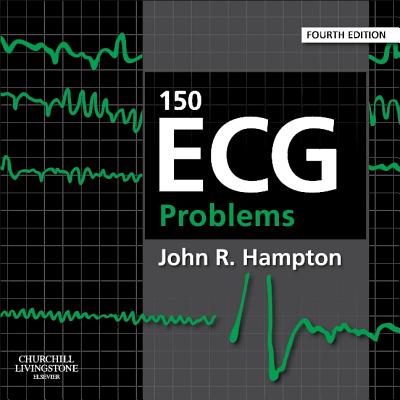 150 ECG Problems - Hampton, John, Professor, DM, MA, DPhil, FRCP