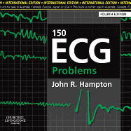 150 ECG Problems