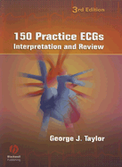 150 Practice ECGs: Interpretation and Review