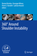 360� Around Shoulder Instability