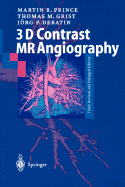 3D Contrast MR Angiography