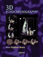 3D Echocardiography
