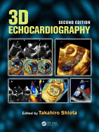 3D Echocardiography