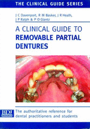 A Clinical Guide to Removable Partial Dentures