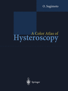 A Color Atlas of Hysteroscopy