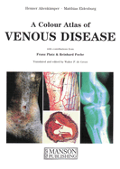 A Colour atlas of venous disease