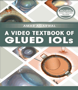 A Video Textbook of Glued Iols