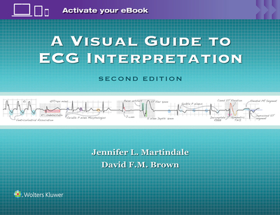 A Visual Guide to ECG Interpretation - Martindale, Jennifer L, MD, and Brown, David F M, MD