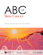 ABC of Skin Cancer