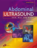 Abdominal Ultrasound: How, Why and When