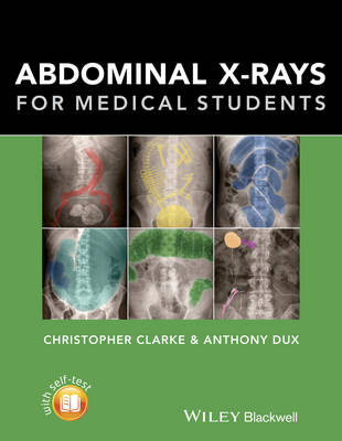 Abdominal X-rays for Medical Students - Clarke, Christopher, and Dux, Anthony