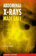 Abdominal X-Rays Made Easy