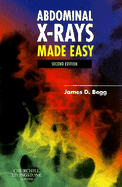 Abdominal X-Rays Made Easy