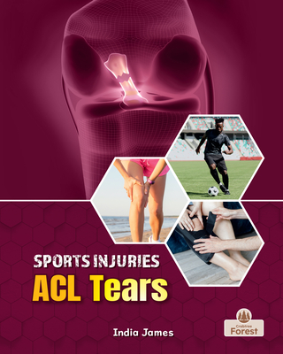 ACL Tears - James, India