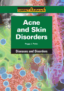 Acne and Skin Disorders