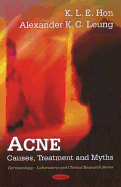 Acne: Causes, Treatment & Myths