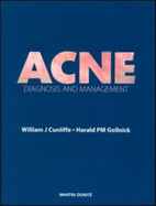 Acne: Diagnosis and Management