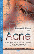 Acne: Etiology, Treatment Options & Social Effects