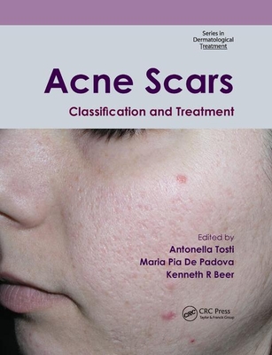 Acne Scars: Classification and Treatment - Tosti, Antonella (Editor), and De Padova, Maria Pia (Editor), and Beer, Kenneth R (Editor)