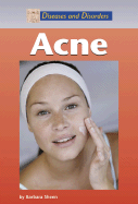Acne