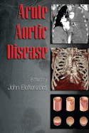 Acute Aortic Disease