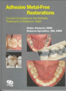 Adhesive Metal Free Restorations