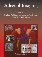 Adrenal Imaging
