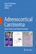 Adrenocortical Carcinoma: Basic Science and Clinical Concepts