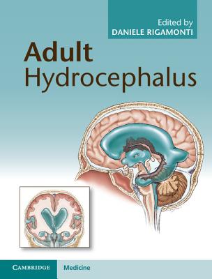 Adult Hydrocephalus - Rigamonti, Daniele, MD (Editor)