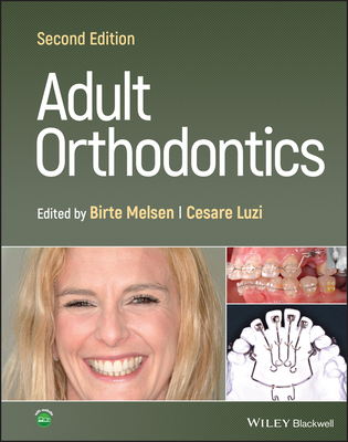 Adult Orthodontics - Melsen, Birte (Editor), and Luzi, Cesare (Editor)