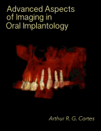 Advanced Aspects of Imaging in Oral Implantology