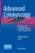Advanced Colonoscopy: Principles and Techniques Beyond Simple Polypectomy