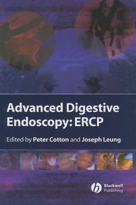 Advanced Digestive Endoscopy: ERCP - Cotton, Peter B (Editor), and Leung, Joseph W (Editor)