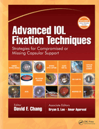 Advanced Iol Fixation Techniques: Strategies for Compromised or Missing Capsular Support