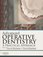 Advanced Operative Dentistry: A Practical Approach