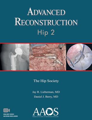 Advanced Reconstruction: Hip 2 - Berry, Daniel J. (Editor), and Lieberman, Jay R. (Editor)