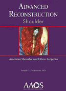 Advanced Reconstruction: Shoulder - Zuckerman, Joseph D