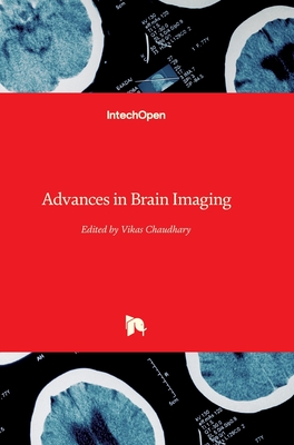 Advances in Brain Imaging - Chaudhary, Vikas (Editor)