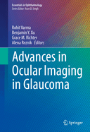 Advances in Ocular Imaging in Glaucoma