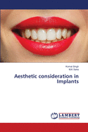 Aesthetic consideration in Implants