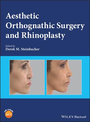 Aesthetic Orthognathic Surgery and Rhinoplasty - Steinbacher, Derek M. (Editor)