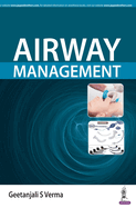 Airway Management