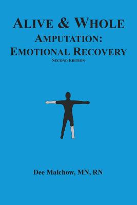 Alive & Whole Amputation: Emotional Recovery - Malchow Mn, Rn Dee