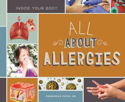 All about Allergies - Potts Francesca Rn