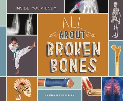 All about Broken Bones - Potts Francesca Rn