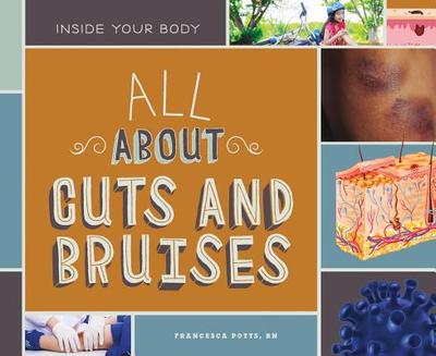 All about Cuts and Bruises - Potts Francesca Rn